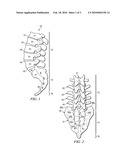 INTERVERTEBRAL PROSTHETIC DEVICE FOR SPINAL STABILIZATION AND METHOD OF MANUFACTURING SAME diagram and image