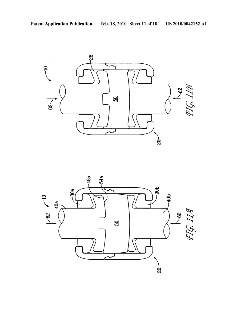 Apparatus for Stabilizing Vertebral Bodies - diagram, schematic, and image 12