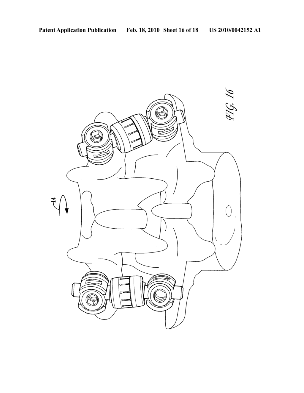 Apparatus for Stabilizing Vertebral Bodies - diagram, schematic, and image 17