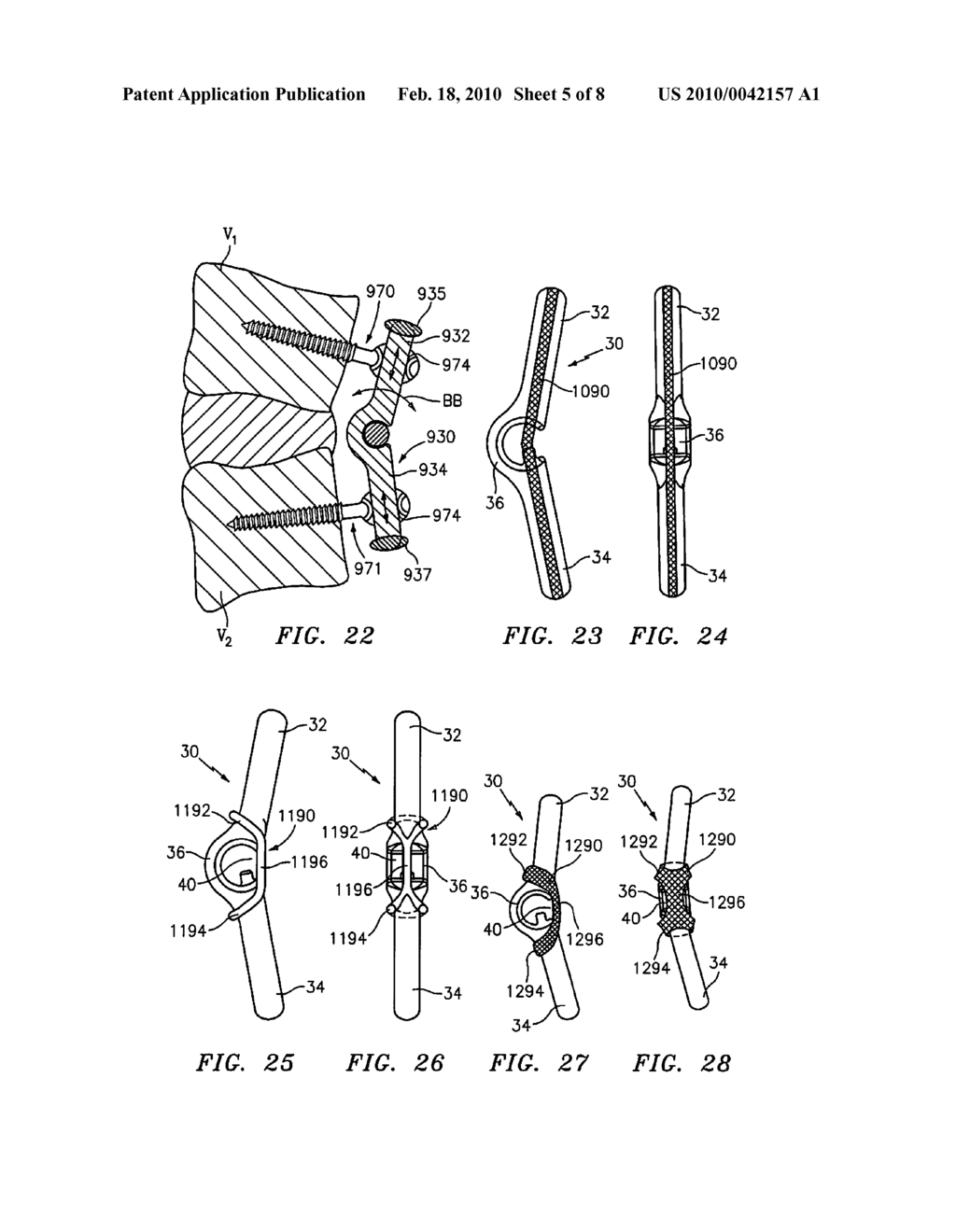 VERTEBRAL ROD SYSTEM AND METHODS OF USE - diagram, schematic, and image 06