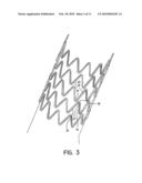 Self-Expanding Stent diagram and image