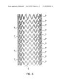 Self-Expanding Stent diagram and image