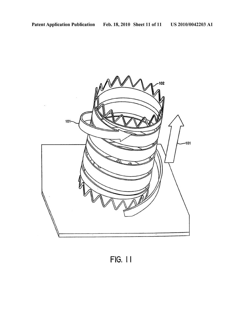 Self-Expanding Stent - diagram, schematic, and image 12