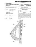 SOFT FILLED PROSTHESIS SHELL WITH DISCRETE FIXATION SURFACES diagram and image