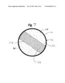 SOFT FILLED PROSTHESIS SHELL WITH DISCRETE FIXATION SURFACES diagram and image