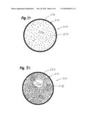 SOFT FILLED PROSTHESIS SHELL WITH DISCRETE FIXATION SURFACES diagram and image