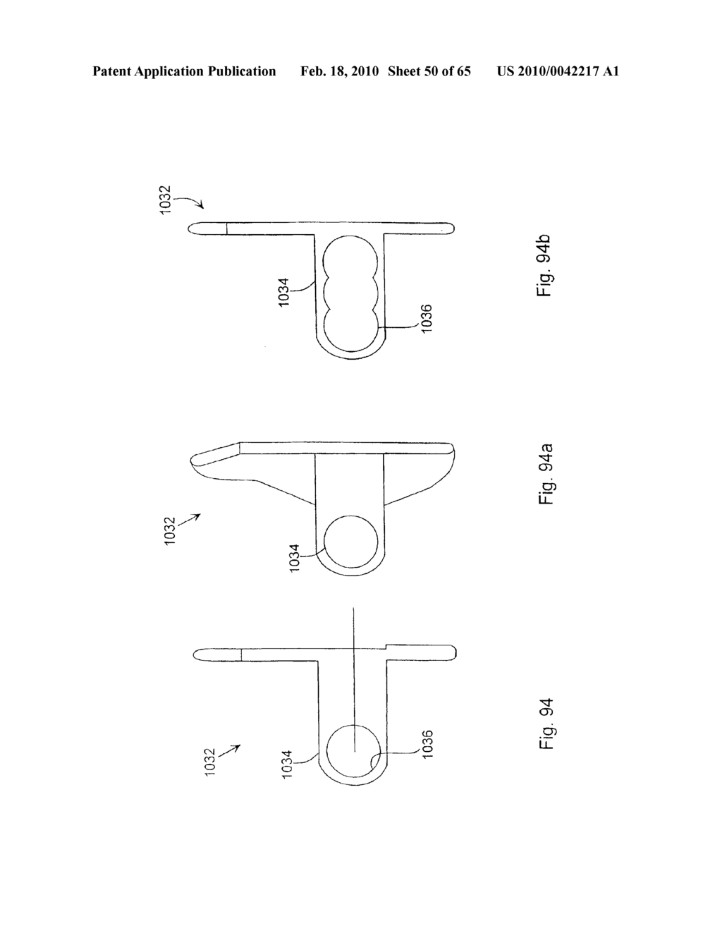 SPINE DISTRACTION IMPLANT AND METHOD - diagram, schematic, and image 51