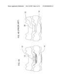 BONE FIXATION SURFACES FOR INTERVERTEBRAL IMPLANTS diagram and image