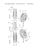 BONE FIXATION SURFACES FOR INTERVERTEBRAL IMPLANTS diagram and image