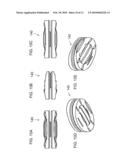 BONE FIXATION SURFACES FOR INTERVERTEBRAL IMPLANTS diagram and image