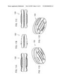 BONE FIXATION SURFACES FOR INTERVERTEBRAL IMPLANTS diagram and image