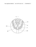 Maxillary Sinus Bone Graft Method Using the Sinus Lift Drill (SLD) and Hydraulic Effect diagram and image