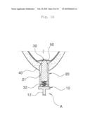 Maxillary Sinus Bone Graft Method Using the Sinus Lift Drill (SLD) and Hydraulic Effect diagram and image