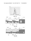 Method and Device for Controlling Auto Focusing of a Video Camera by Tracking a Region-of-Interest diagram and image