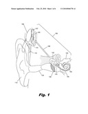 INTEGRATED COCHLEAR IMPLANT HEADPIECE diagram and image