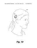 INTEGRATED COCHLEAR IMPLANT HEADPIECE diagram and image