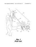 MODULAR SPEECH PROCESSOR HEADPIECE diagram and image