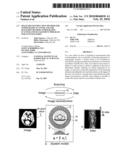 IMAGE RECONSTRUCTION METHOD FOR TOMOGRAPHY SCANNER, FAILURE DIAGNOSIS METHOD, TOMOGRAPHY SCANNER AND MANAGEMENT PROGRAM FOR SYSTEM MATRIX diagram and image