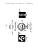 IMAGE RECONSTRUCTION METHOD FOR TOMOGRAPHY SCANNER, FAILURE DIAGNOSIS METHOD, TOMOGRAPHY SCANNER AND MANAGEMENT PROGRAM FOR SYSTEM MATRIX diagram and image