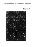 Synthetic LDL as Targeted Drug Delivery Vehicle diagram and image