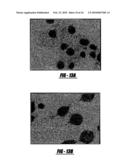 VACCINE IMMUNOTHERAPY diagram and image