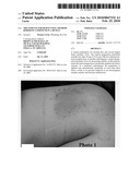 Treatments for burns using thyroid hormone compound in a human diagram and image