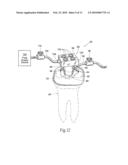 Apparatus and methods for treating tooth root canals diagram and image