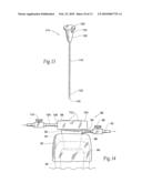 Apparatus and methods for treating tooth root canals diagram and image