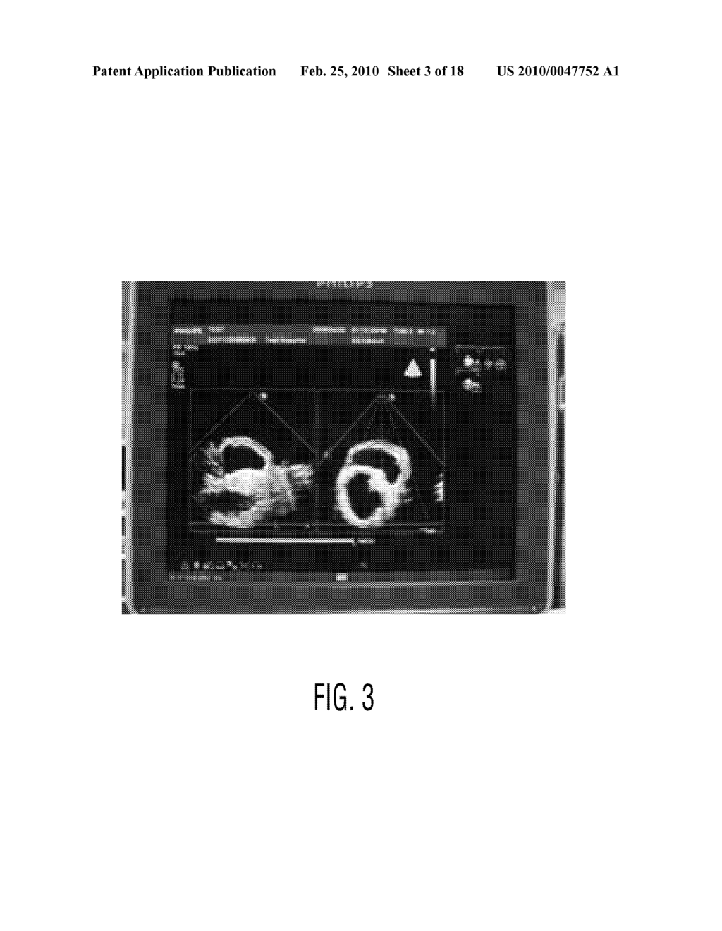 ANATOMICALLY AND FUNCTIONALLY ACCURATE SOFT TISSUE PHANTOMS AND METHOD FOR GENERATING SAME - diagram, schematic, and image 04