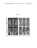 Compositions and Methods for Treating Diseases Associated with T-Box and N-Myc diagram and image