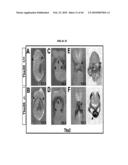 Compositions and Methods for Treating Diseases Associated with T-Box and N-Myc diagram and image