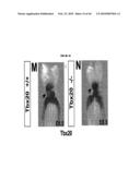 Compositions and Methods for Treating Diseases Associated with T-Box and N-Myc diagram and image