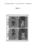 Compositions and Methods for Treating Diseases Associated with T-Box and N-Myc diagram and image