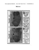 Compositions and Methods for Treating Diseases Associated with T-Box and N-Myc diagram and image