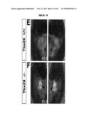 Compositions and Methods for Treating Diseases Associated with T-Box and N-Myc diagram and image