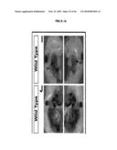 Compositions and Methods for Treating Diseases Associated with T-Box and N-Myc diagram and image