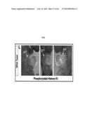 Compositions and Methods for Treating Diseases Associated with T-Box and N-Myc diagram and image