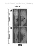 Compositions and Methods for Treating Diseases Associated with T-Box and N-Myc diagram and image