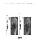 Compositions and Methods for Treating Diseases Associated with T-Box and N-Myc diagram and image