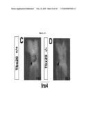 Compositions and Methods for Treating Diseases Associated with T-Box and N-Myc diagram and image