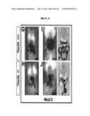 Compositions and Methods for Treating Diseases Associated with T-Box and N-Myc diagram and image