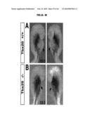 Compositions and Methods for Treating Diseases Associated with T-Box and N-Myc diagram and image