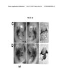 Compositions and Methods for Treating Diseases Associated with T-Box and N-Myc diagram and image