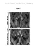 Compositions and Methods for Treating Diseases Associated with T-Box and N-Myc diagram and image