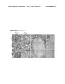 METHOD FOR THE DETECTION OF INTERFERON-ASSOCIATED ANGIOSTATIC TUMORSTAGES IN COLORECTAL CARCINOMA diagram and image