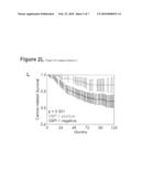 METHOD FOR THE DETECTION OF INTERFERON-ASSOCIATED ANGIOSTATIC TUMORSTAGES IN COLORECTAL CARCINOMA diagram and image