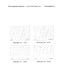 USE OF PHOSPHOLIPIDS FOR WOUND HEALING diagram and image