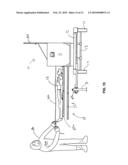 Method and device for safe handling and removal of bodily remains diagram and image