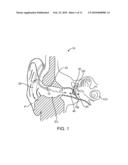 Optical Electro-Mechanical Hearing Devices With Separate Power and Signal Components diagram and image