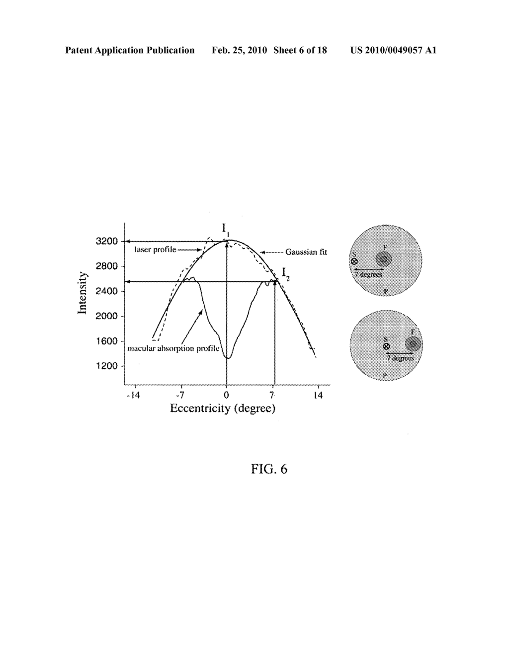 IMAGING OF MACULAR PIGMENT DISTRIBUTIONS - diagram, schematic, and image 07